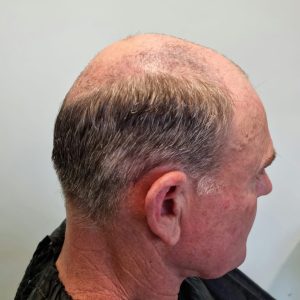 Men's hairpiece fitting in Stockport