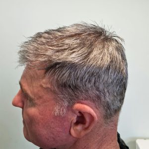 Hairpieces for hair loss in Stockport