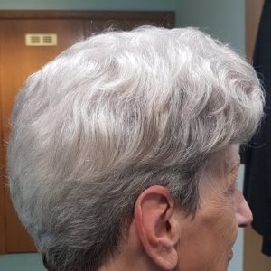 Grey/white hairpiece fitted due to hair loss in Stockport
