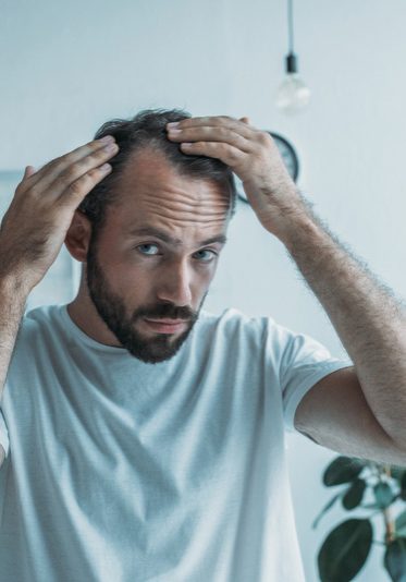 Younger man checking his hairline