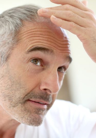 Older man checking for hair loss